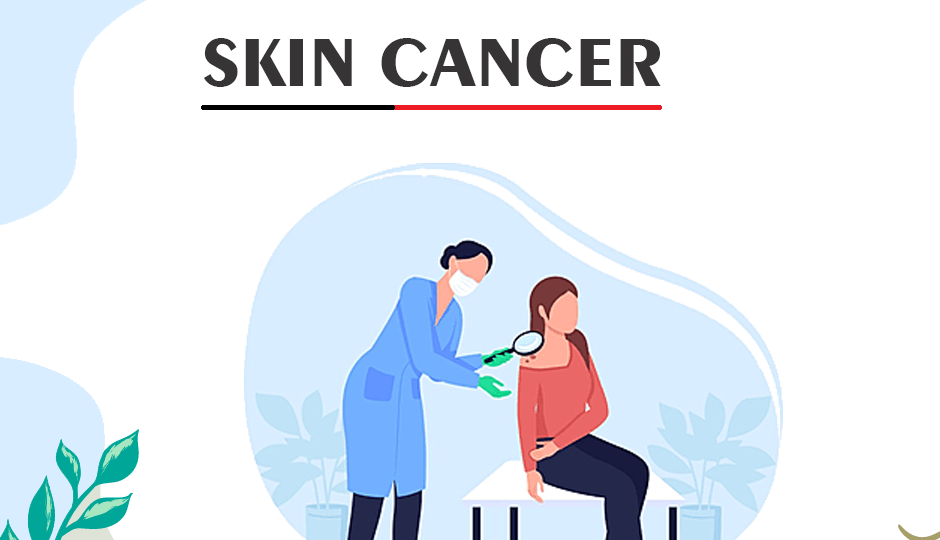 skin care - skin cancer