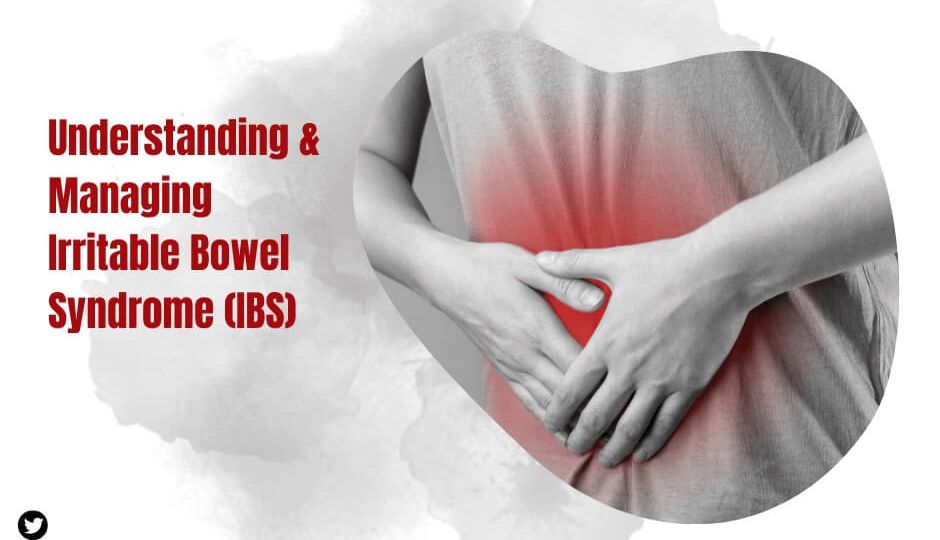 Understanding and Managing Irritable Bowel Syndrome (IBS)